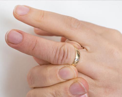 Jak zdjąć pierścionek z opuchniętego palca? Kilka porad.